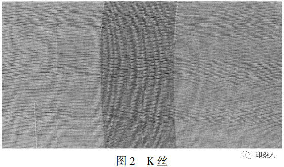 定型机,涂层机,地毯机,地毯背胶机,静电植绒机